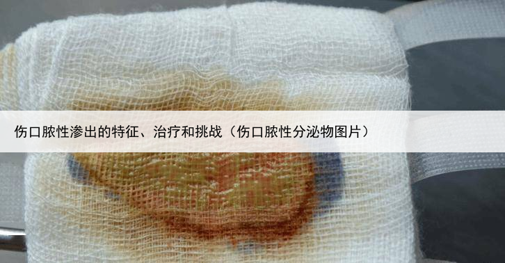 伤口脓性渗出的特征、治疗和挑战（伤口脓性分泌物图片）
